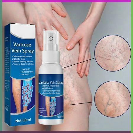 Herbal Varicose Veins Treatment Spray